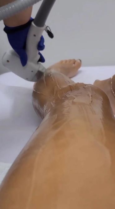 Full Legs Hair Removal