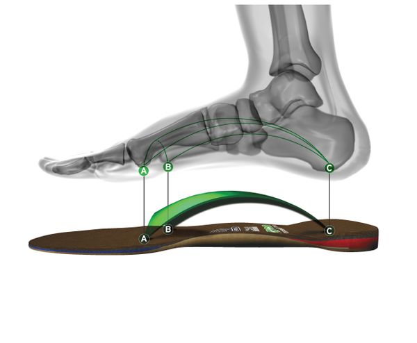 Plantar fasciitis image showing how it affects your feet