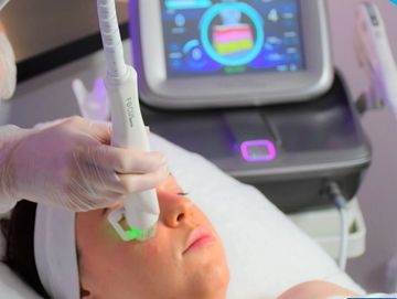 Radio frequency Microneedling (RF Microneedling) for skin rejuvenation, giving skin back it's snap!