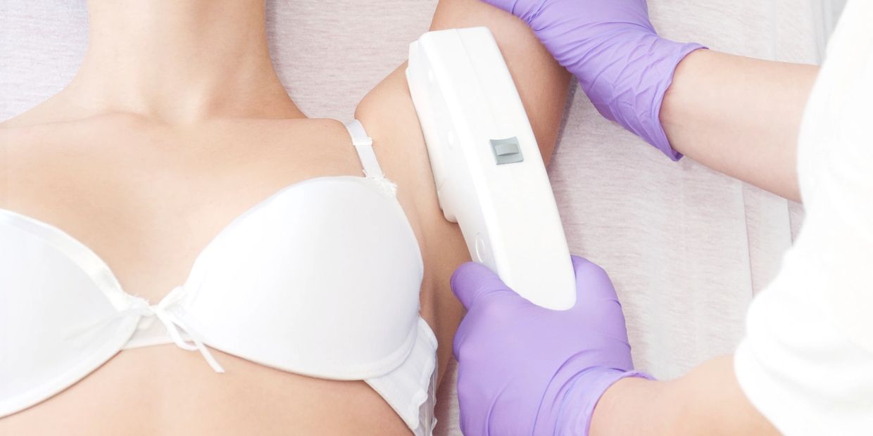 IPL for hair removal or skin rejuvenation. 
Hythe, Southampton