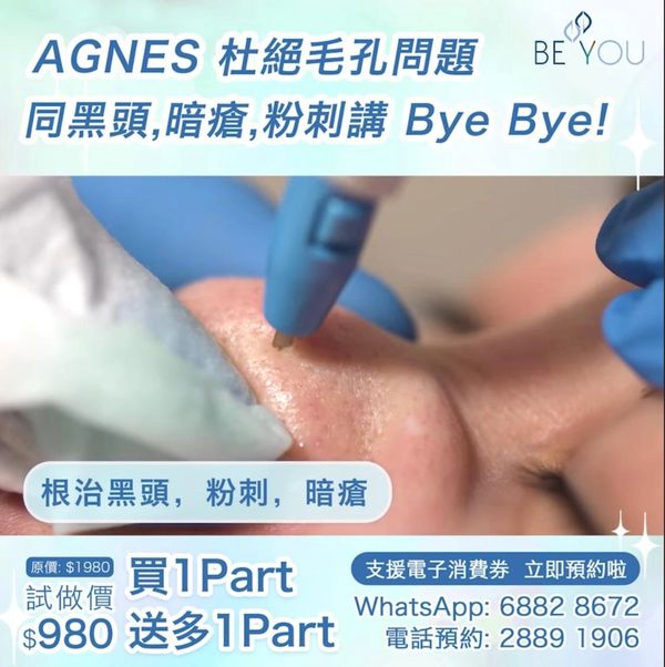 【AGNES 醫學級💉微針絕緣射頻】
徹底破壞皮脂腺 擊退暗瘡黑頭粉刺🥊
BeYou 復業優惠🚨$980🚨買一送一
📆幾個月無做 Facial,加上日日戴口罩😷,配合埋又熱又濕嘅天氣🌦