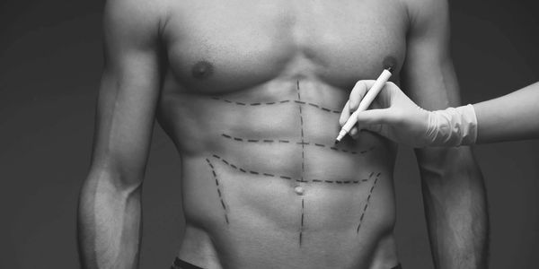 Man representing cosmetic abdominal sculpting
