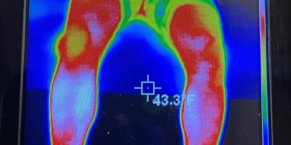 Thermal image showing heat distribution on a person's legs and lower torso.
