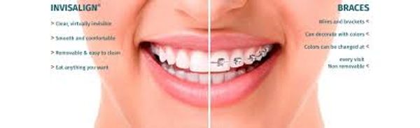 orthodontics invisalign orthodontics braces invisalign braces brackets orthodontics invisalign best