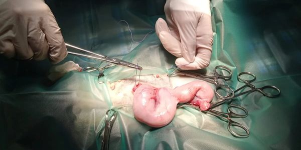 Médico realizando una cirugía