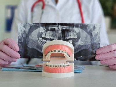 Dental model with braces in front of X-ray