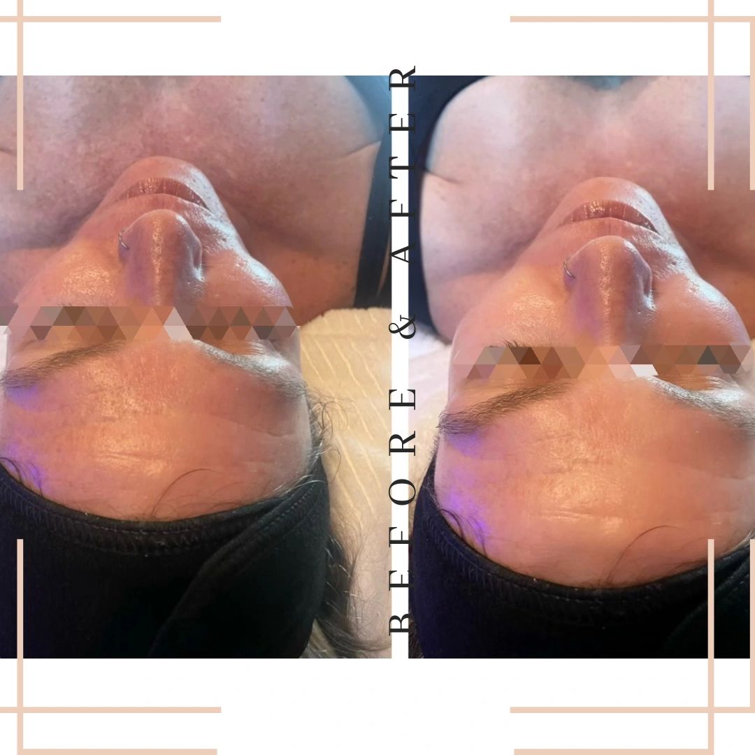 Anti-Aging LED Facial w/ Circadia Firming Mask