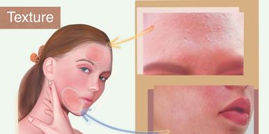 Skincare solution for enlarged pores, sagging skin, and fine lines.