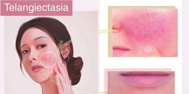 Best wrinkle reduction mask with heat therapy and collagen support