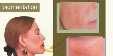 Advanced skincare mask at home for sagging, fine lines, and collagen enhancement