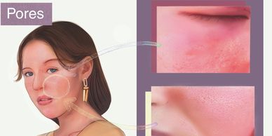 Best anti-aging skincare routine using heat therapy devices at home