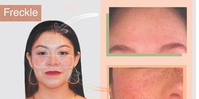 t-home skincare device to tighten skin, minimize pores, and improve elasticity