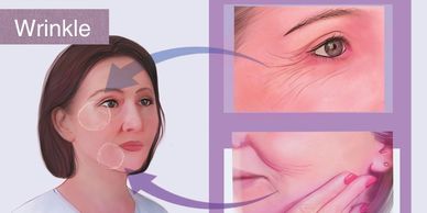 Best skincare device for wrinkle reduction and collagen boosting.