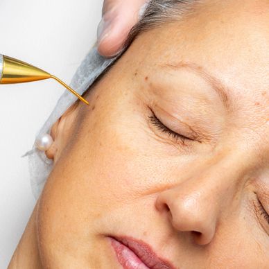 botox nj, filler nj, lip injections nj, lipo nj, plasma fibroblast nj, needleless filler nj