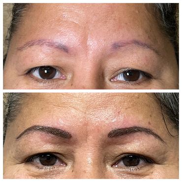 Correcting Brow work done Elsewhere. Before & After