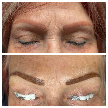 Correcting Brow work done Elsewhere. Before & After