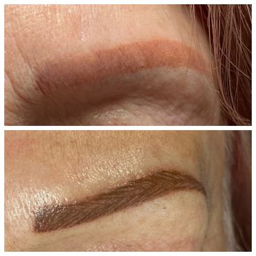 Correcting Brow work done Elsewhere. Before & After