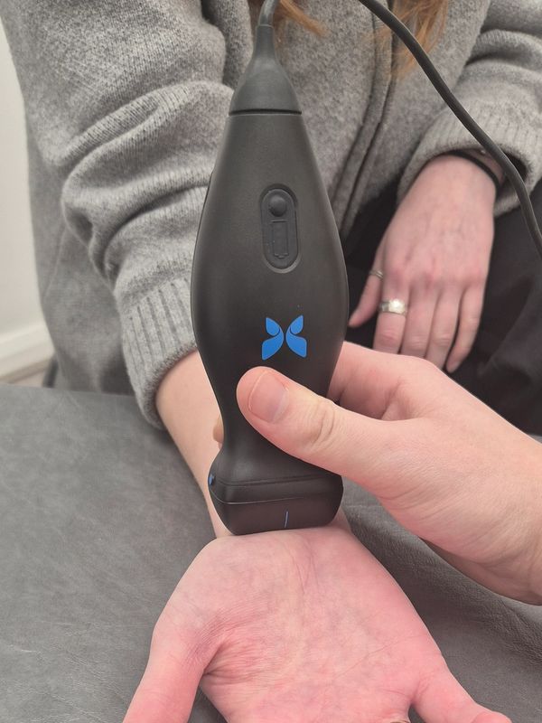 Ultrasound of a wrist. This method can be used to provide ultrasound guided steroid injection