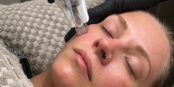 Woman receiving facial non-needle mesotherapy treatment.