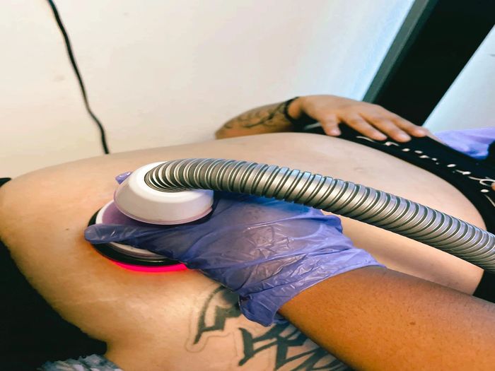 Cavitation.Laser Lipo. Skin Toning and Tightening of body and face . Sauna Blanket.