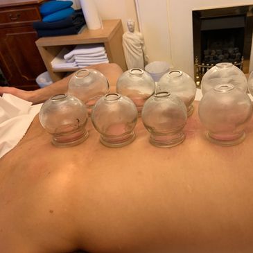 cupping, myo fascial release, relaxation, stress and anxiety