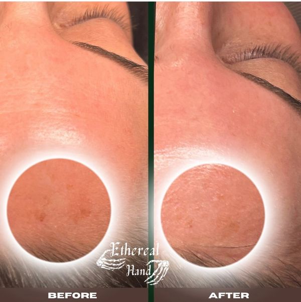 Organic skin lightening (spot treatment)