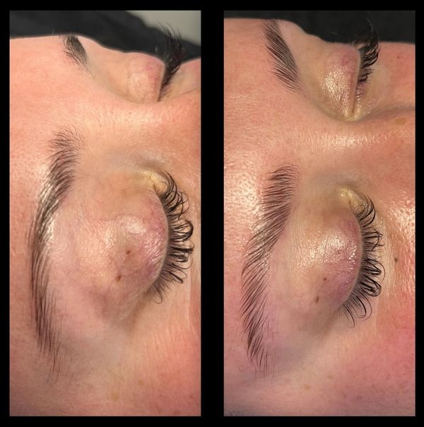 Before and After Brow Lamination