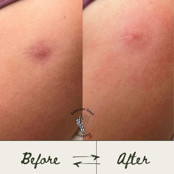 Before and after 1 Organic skin lighting.