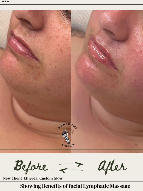 New Client Ethereal Custom Glow! 
Results of facial and facial Lymphatic massage