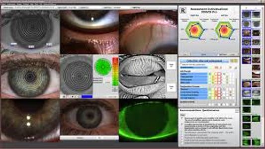 Jenvis Pro Dry Eye Assessment