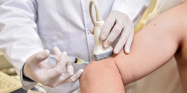 PRP injections in Columbus