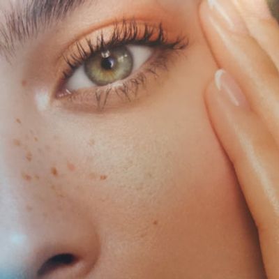 Close-up of a green eye with freckles and hand touching the face.