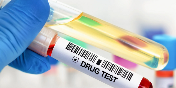 Mobile Drug & Alcohol Testing