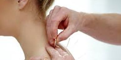 Dry needling Trigger point deep muscle 
Relief
pain
deep tissue
movement