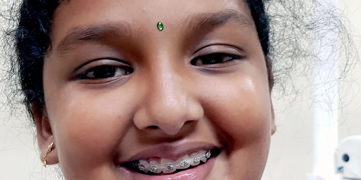 orthodontic treatment