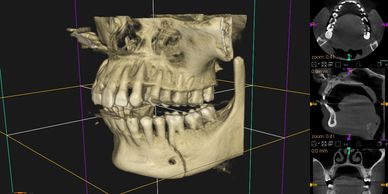 Oral and Maxillofacial Surgery