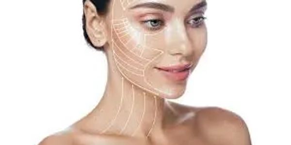 Woman with facial mapping lines illustrating skin treatment areas.