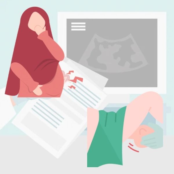 Intrapartum