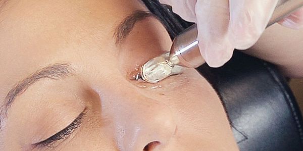 Photo of MiBo Flo ThermoFlo treatment on a Female Patient