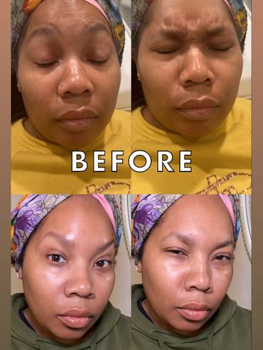 Before and after skincare photos showing reduced wrinkles and glowing skin.