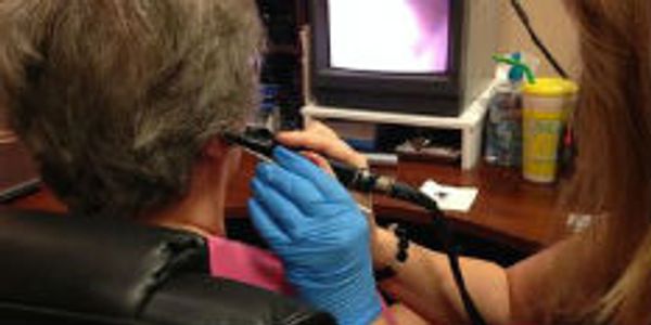 Image of Ear Wax being removed. There is a monitor to view the Ear Wax Removal Process. Orange City