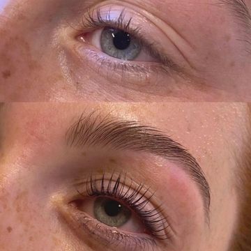 Comparison of eyes before and after enhancement.