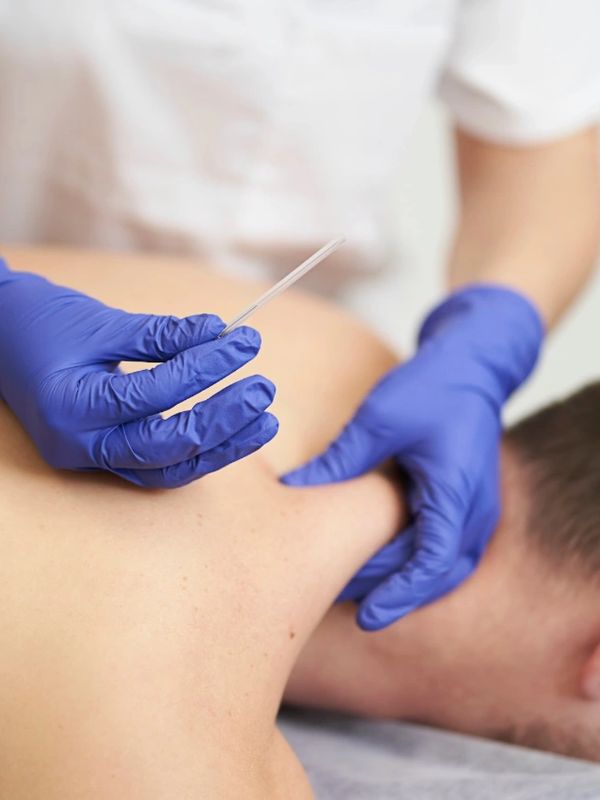 Medical professional wearing gloves preparing acupuncture on a patient's neck.