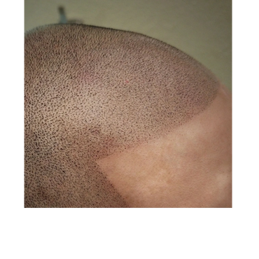 Close up of SMP, with a sharp hairline style