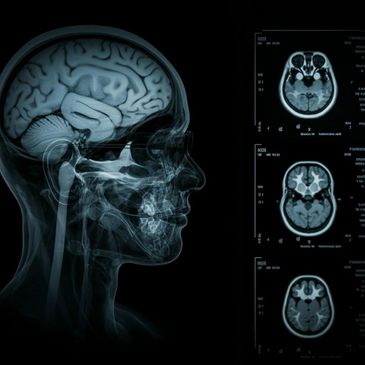 Side profile X-ray and MRI scans showing detailed brain structures.