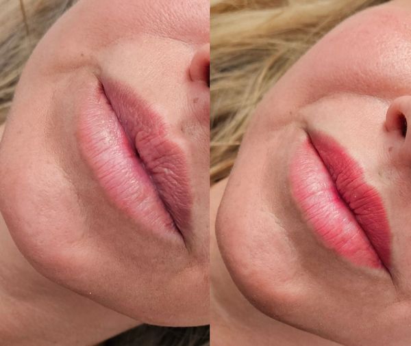Before and after- a healed lip blush treatment.