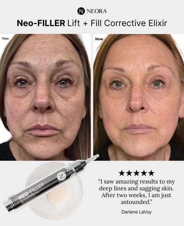 Before and after photos show reduced wrinkles using Neo-FILLER Corrective Elixir.