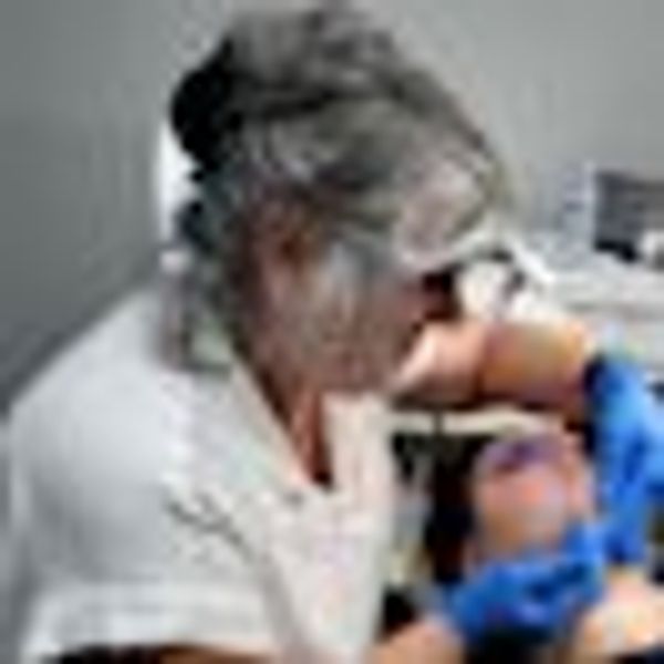 Maria performing electrolysis on facial hair