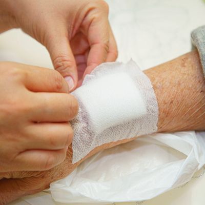 wound care in Bristol, a wound being checked by a private nurse in Bristol 