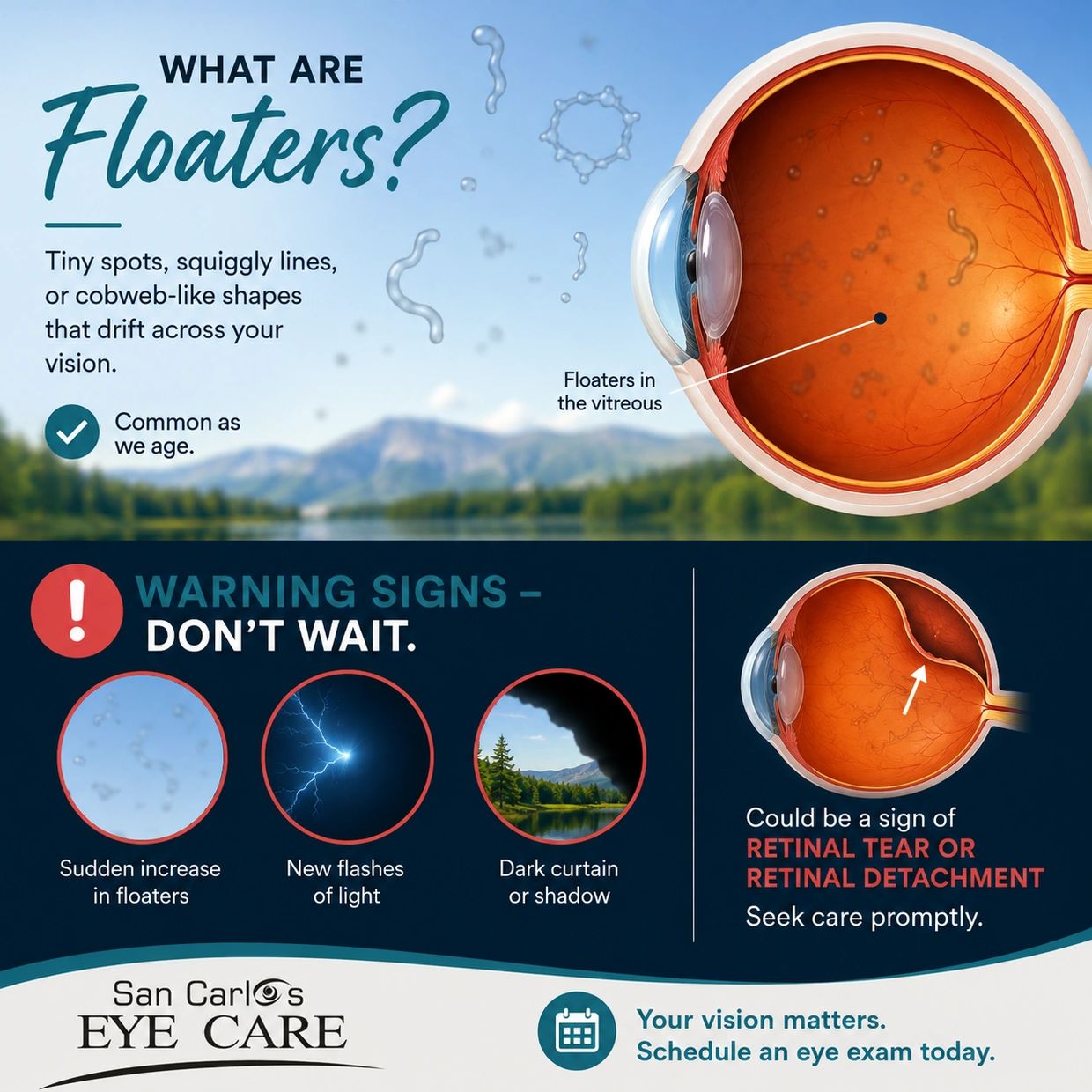 Illustration of eye floaters and flashes showing spots and cobweb-like shapes that may appear in vis